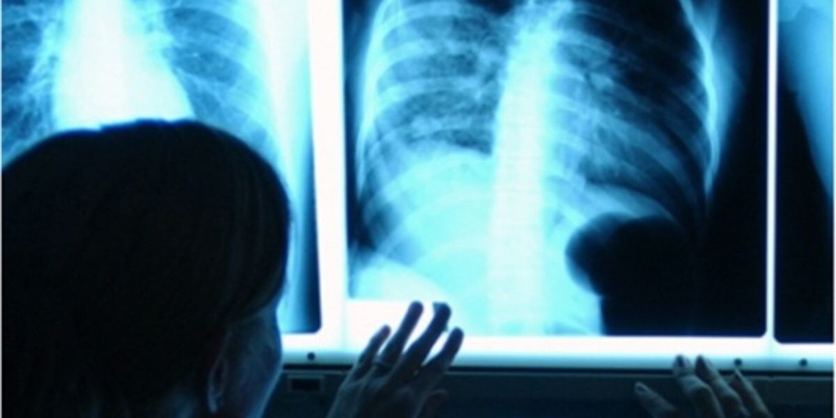 ¿Qué habilidades necesita un profesional de Bioimágenes? Especialista utilizando tecnología médica y atendiendo pacientes