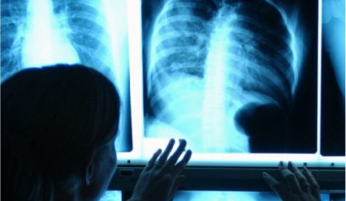 ¿Qué habilidades necesita un profesional de Bioimágenes? Especialista utilizando tecnología médica y atendiendo pacientes
